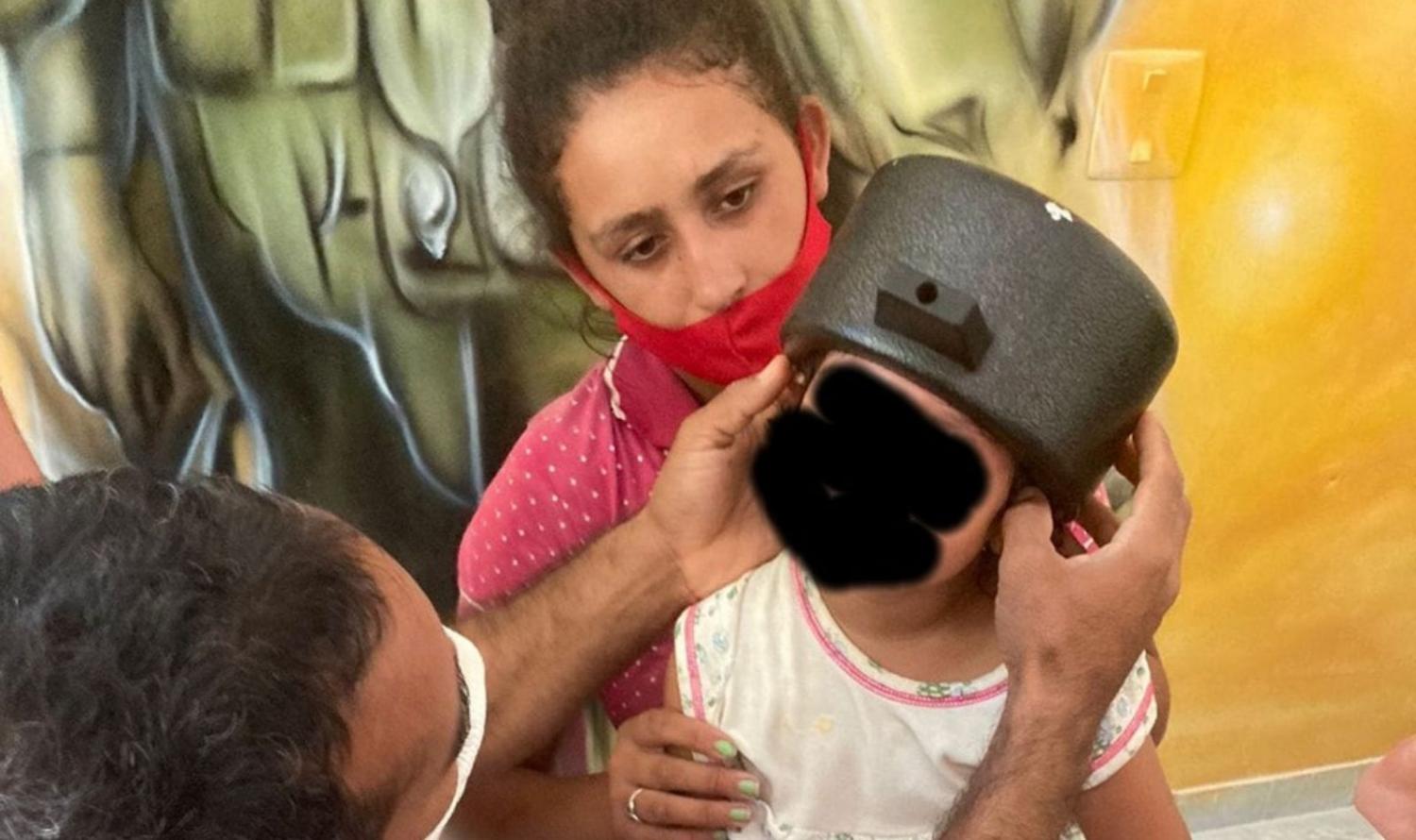 Criança fica com a cabeça presa em panela de pressão em Lagoa do Ouro, PE