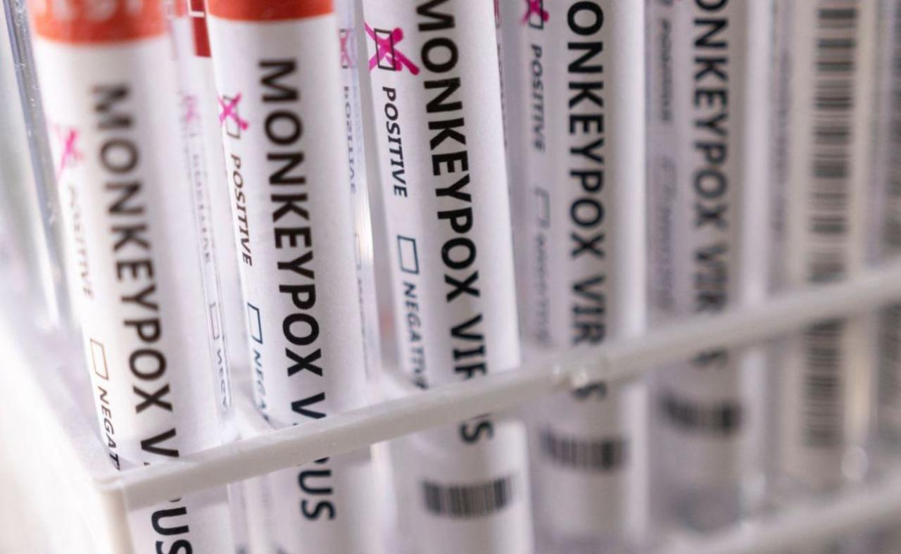 Japão emite alerta de nível 1 para surto global de varíola dos macacos