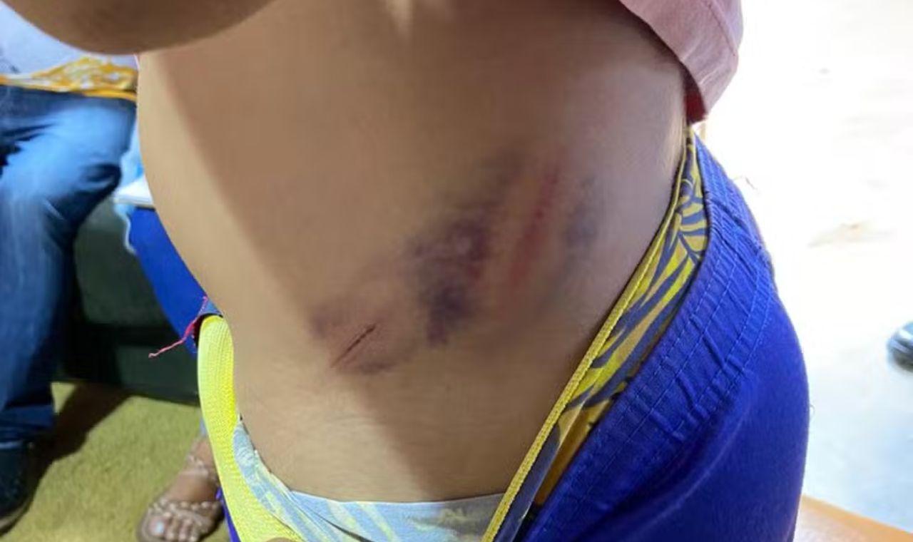 CRIANÇA DE 10 ANOS É ESPANCADA PELO PAI EM BREJO DA MADRE DE DEUS, PE